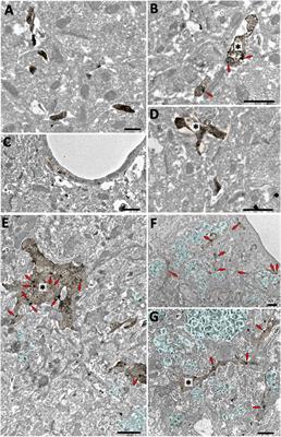 Cannabinoid CB2 Receptors Modulate Microglia Function and Amyloid Dynamics in a Mouse Model of Alzheimer’s Disease